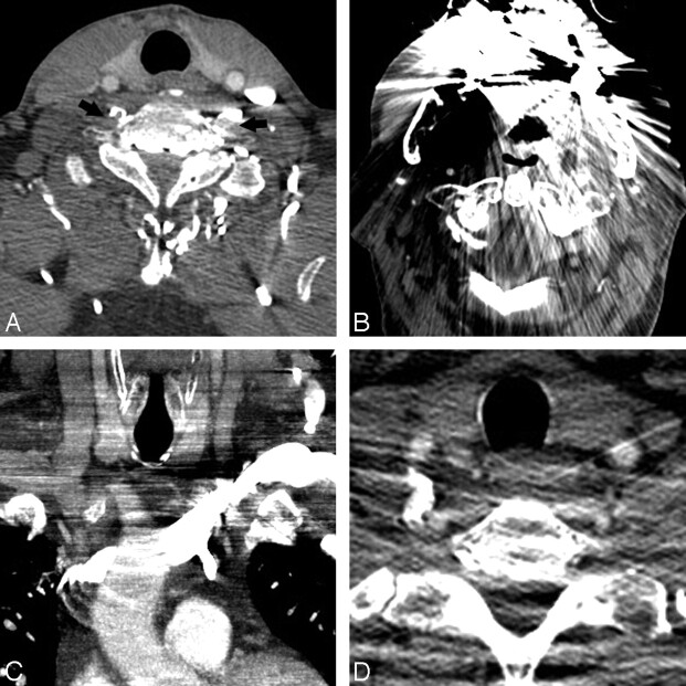 Fig 2.