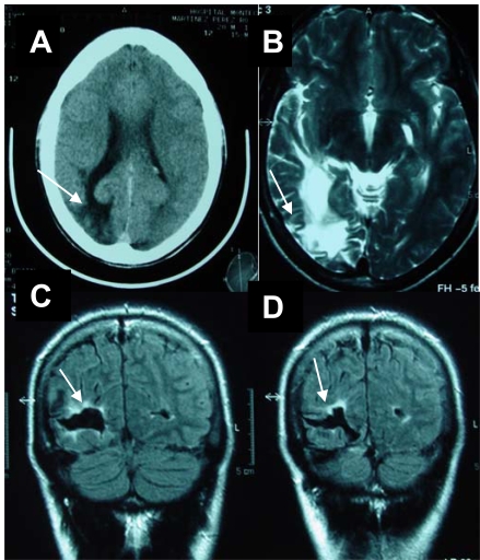 Fig. (1)