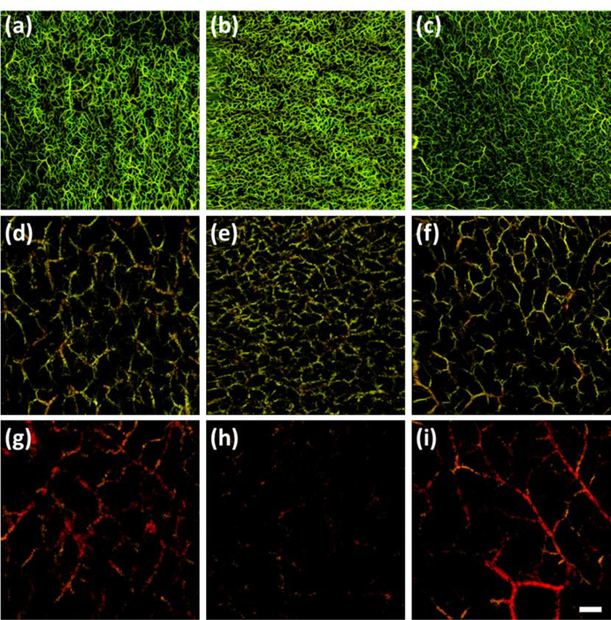 Figure 11: