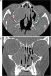 Fig. 6