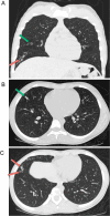 Fig. 2