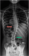 Fig. 5