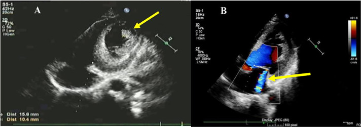 Fig 3