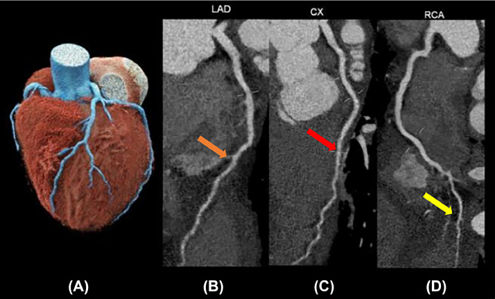 Fig 4