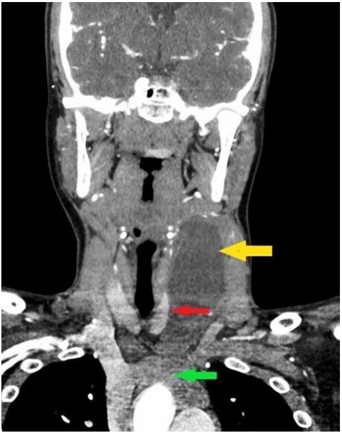 Figure1