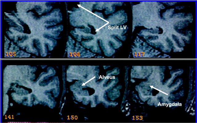 Fig 3.