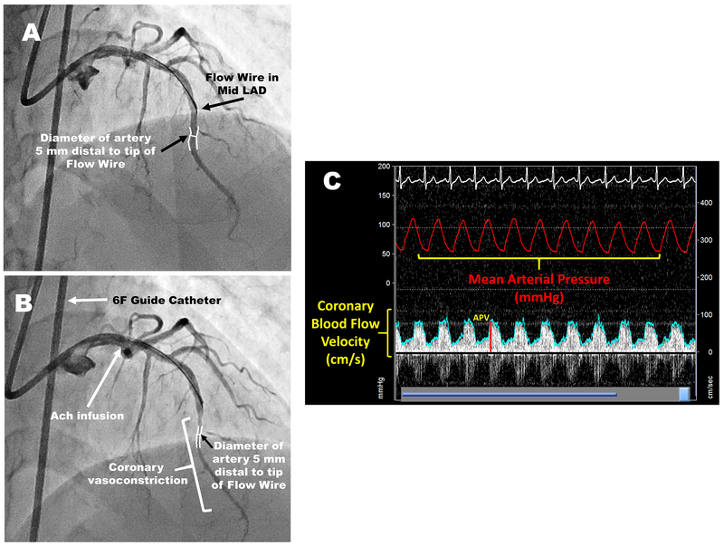 Figure 1: