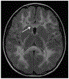 FIGURE 9-8