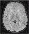 FIGURE 9-5