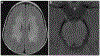 FIGURE 9-3