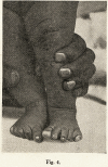 556-3
