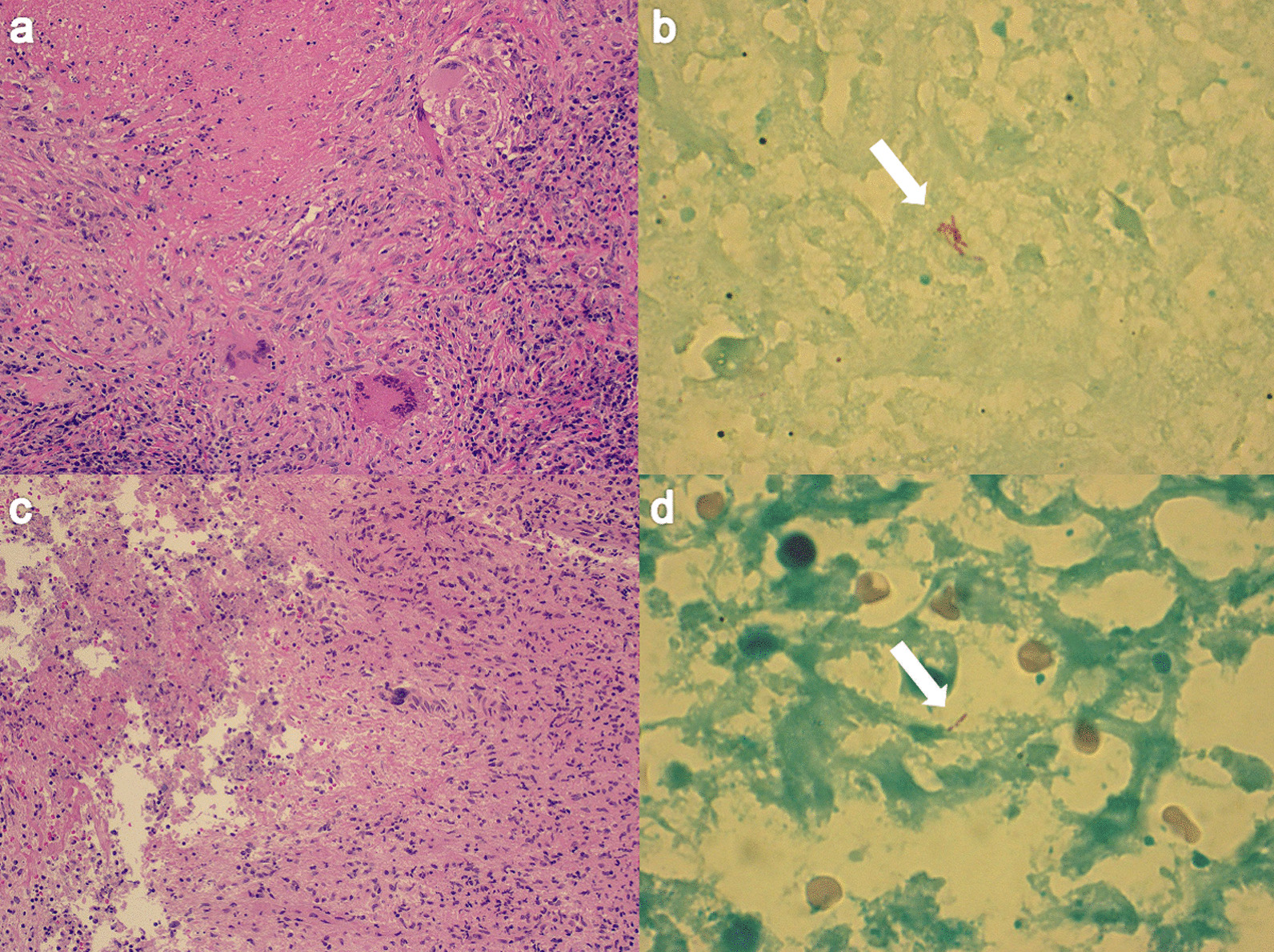 Fig. 4