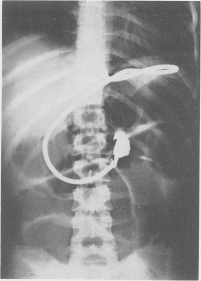 Fig. 1 (Case 1).