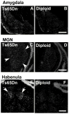 Fig. 11