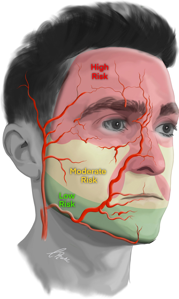 Figure 11: