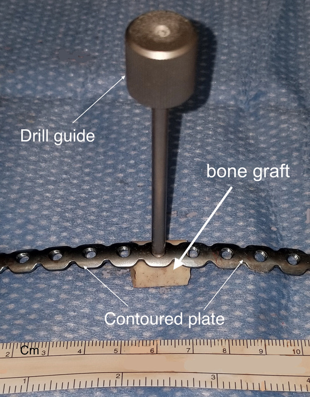 Fig. 14