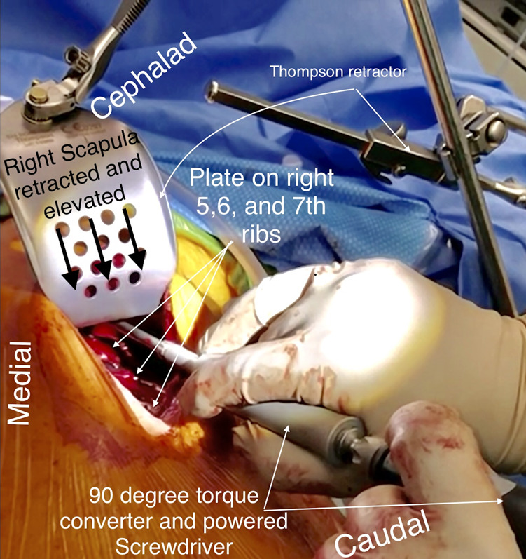 Fig. 18