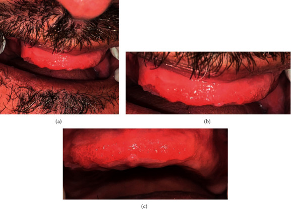 Figure 4