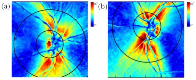 Fig. 12