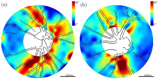 Fig. 11