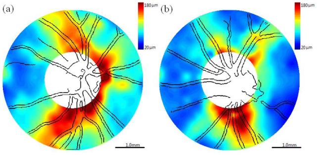 Fig. 10