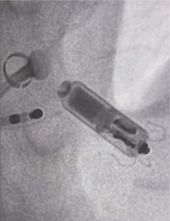 Figure 2.