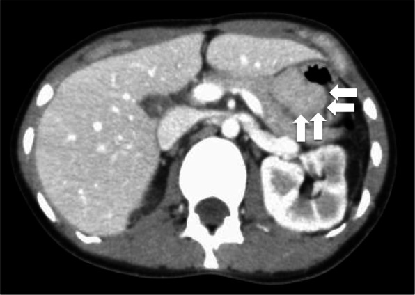 Fig. 5