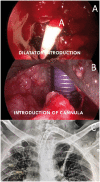 Figure 2: