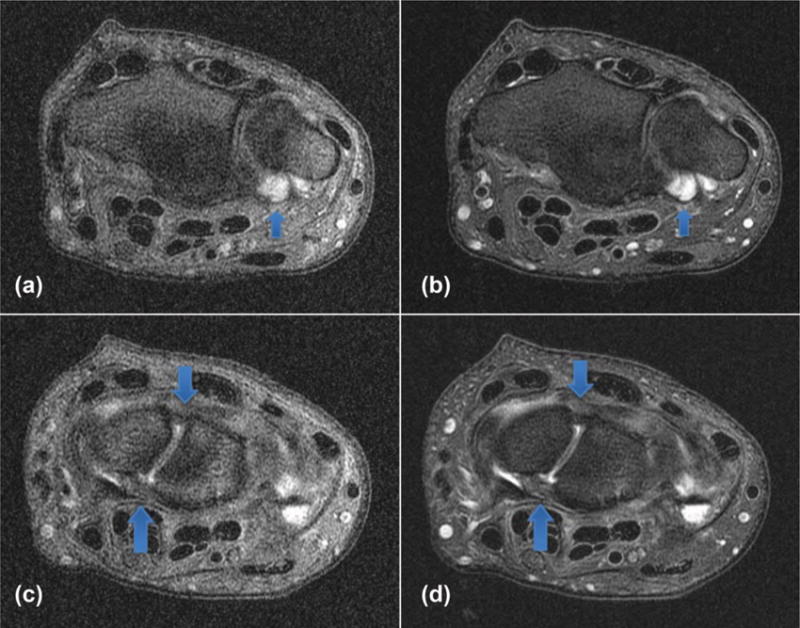 FIG. 5