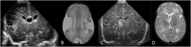 Figure 12