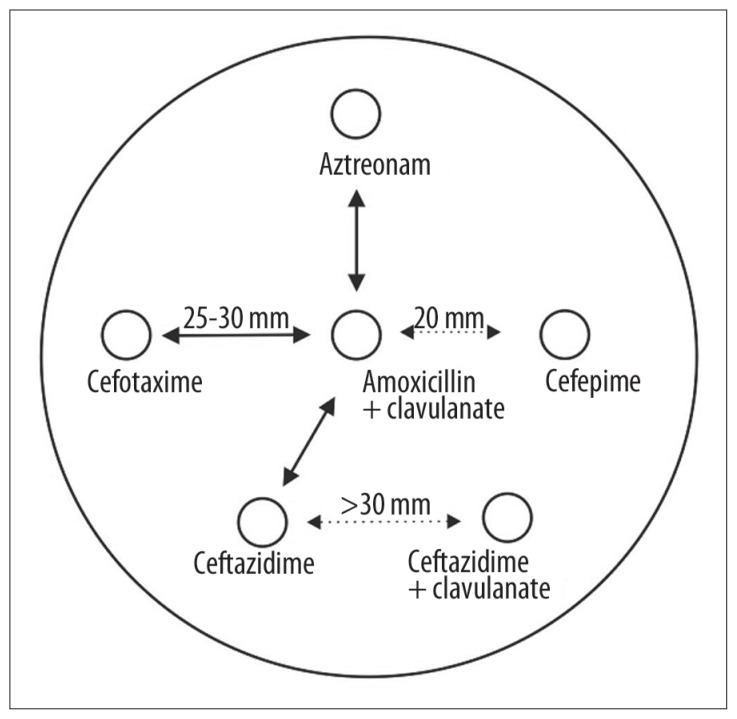 Chart 2