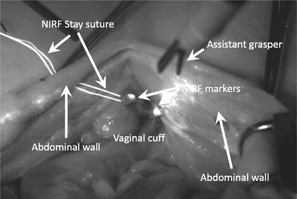 Figure 11.