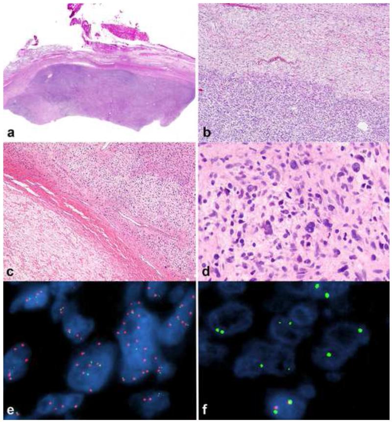 Figure 16