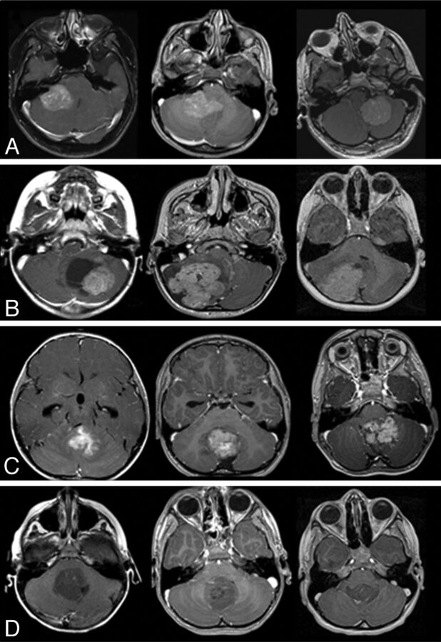 Fig 2.