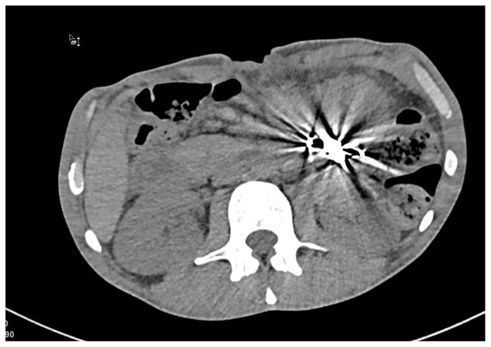 Figure 1 :