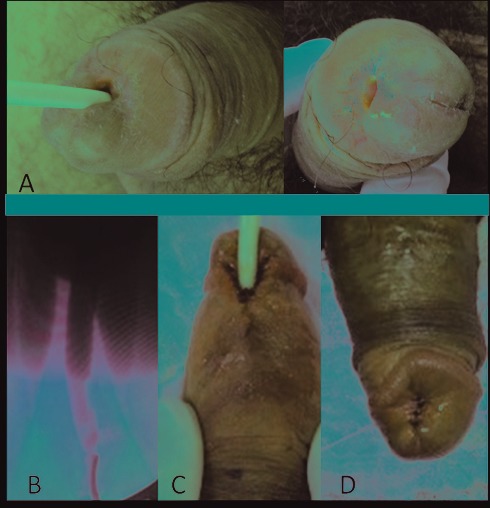 Fig. 1b.