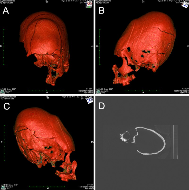 Fig 1