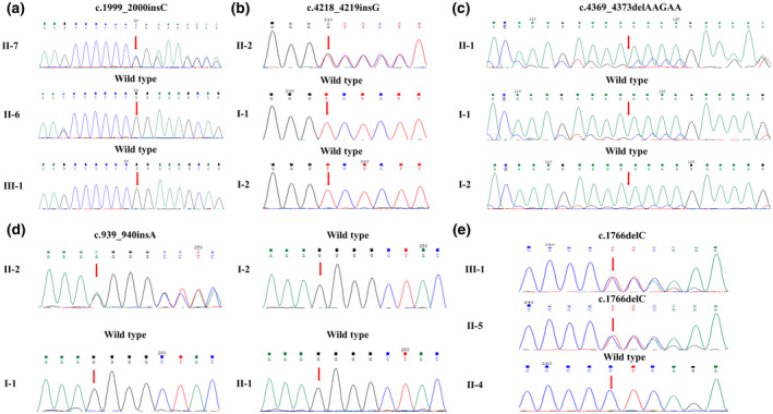 FIGURE 3