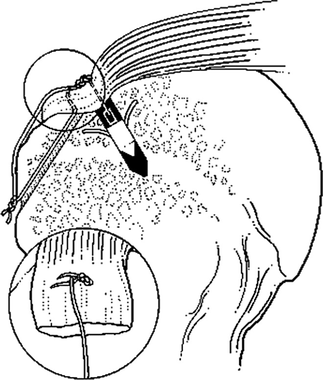 FIG. 1.