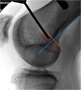 Fig. 5