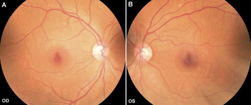 FIGURE 3