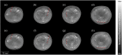 Fig. 9