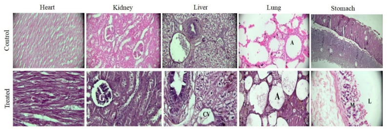 Figure 14