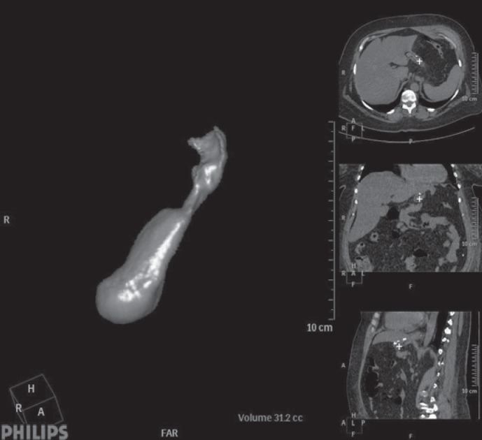 Fig. 3