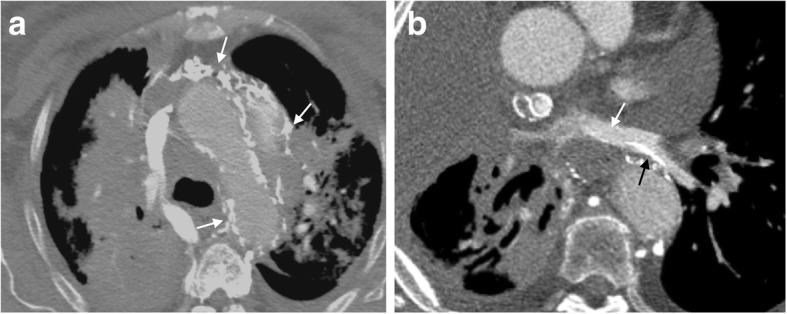 Fig. 12