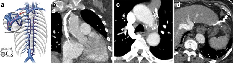 Fig. 11