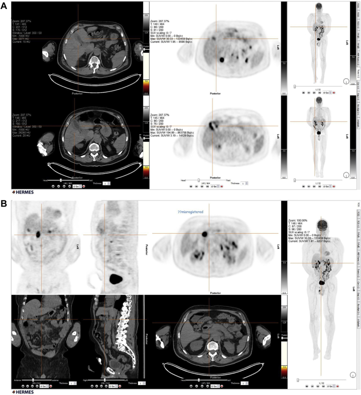 Fig. 10