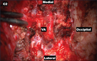 Figure 2: