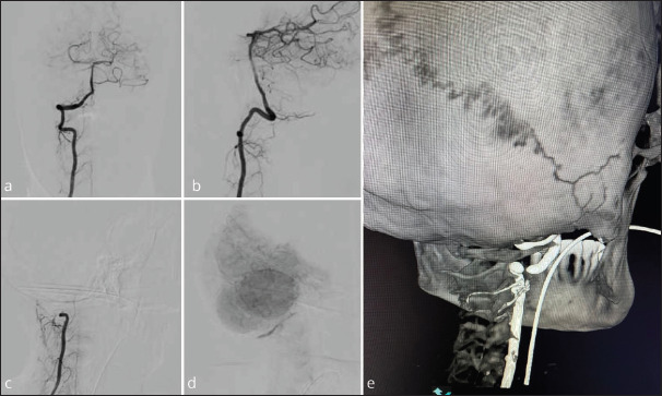 Figure 3: