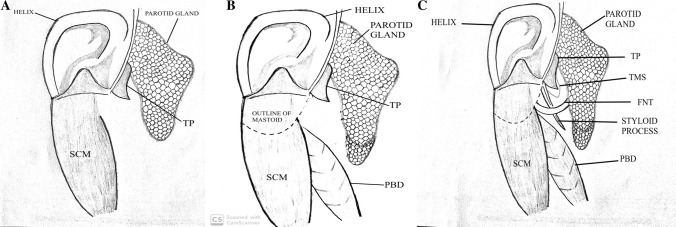 Fig. 1